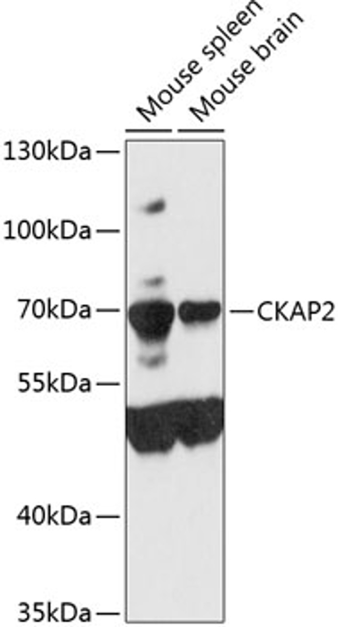 Western blot analysis of extracts of various cell lines, using CKAP2 antibody (23-896) at 1:3000 dilution.<br/>Secondary antibody: HRP Goat Anti-Rabbit IgG (H+L) at 1:10000 dilution.<br/>Lysates/proteins: 25ug per lane.<br/>Blocking buffer: 3% nonfat dry milk in TBST.<br/>Detection: ECL Enhanced Kit.<br/>Exposure time: 90s.