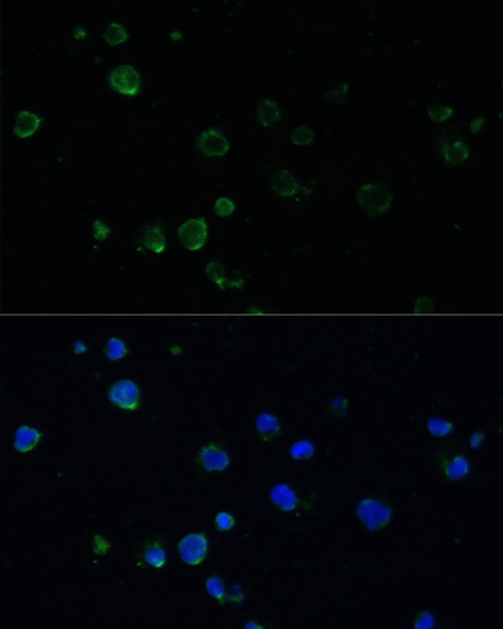 Immunofluorescence analysis of Jurkat cells using PMAIP1 antibody (23-907) at dilution of 1:100. Blue: DAPI for nuclear staining.