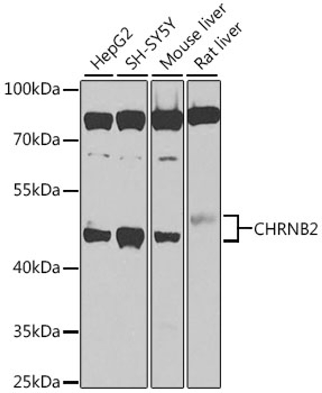 Western blot analysis of extracts of various cell lines, using CHRNB2 antibody (23-913) at 1:1000 dilution.<br/>Secondary antibody: HRP Goat Anti-Rabbit IgG (H+L) at 1:10000 dilution.<br/>Lysates/proteins: 25ug per lane.<br/>Blocking buffer: 3% nonfat dry milk in TBST.<br/>Detection: ECL Basic Kit.<br/>Exposure time: 90s.