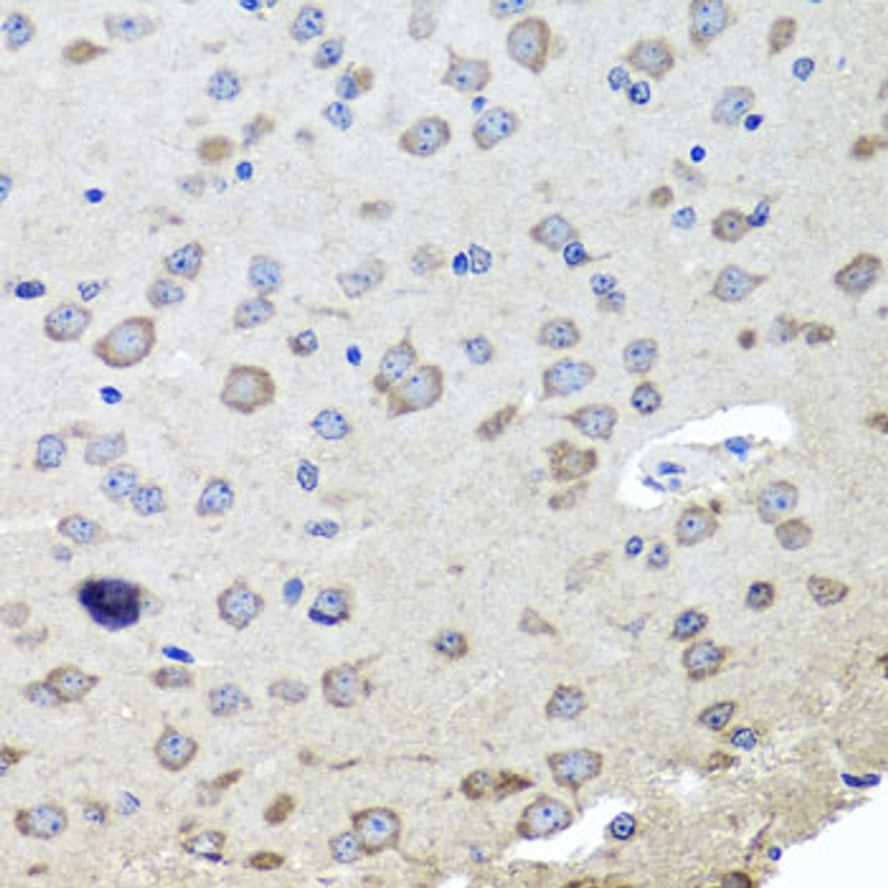 Immunohistochemistry of paraffin-embedded mouse brain using CHRNB2 antibody (23-913) at dilution of 1:100 (40x lens) .