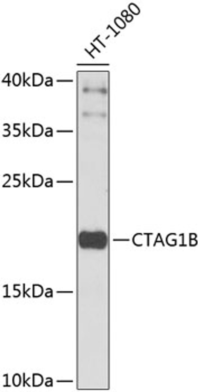 Western blot analysis of extracts of HT-1080 cells, using CTAG1B antibody (23-915) at 1:1000 dilution.<br/>Secondary antibody: HRP Goat Anti-Rabbit IgG (H+L) at 1:10000 dilution.<br/>Lysates/proteins: 25ug per lane.<br/>Blocking buffer: 3% nonfat dry milk in TBST.<br/>Detection: ECL Basic Kit.<br/>Exposure time: 15s.