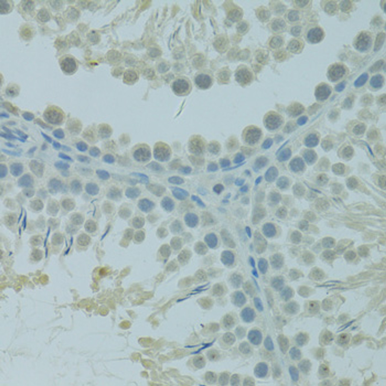 Immunohistochemistry of paraffin-embedded rat testis using CTAG1B antibody (23-915) at dilution of 1:100 (40x lens) .