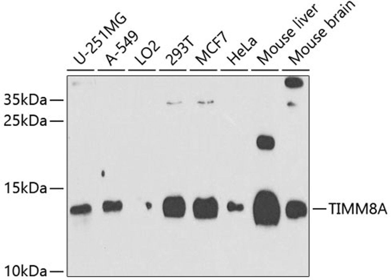 Western blot analysis of extracts of various cell lines, using TIMM8A antibody (23-916) at 1:1000 dilution.<br/>Secondary antibody: HRP Goat Anti-Rabbit IgG (H+L) at 1:10000 dilution.<br/>Lysates/proteins: 25ug per lane.<br/>Blocking buffer: 3% nonfat dry milk in TBST.<br/>Detection: ECL Basic Kit.<br/>Exposure time: 90s.