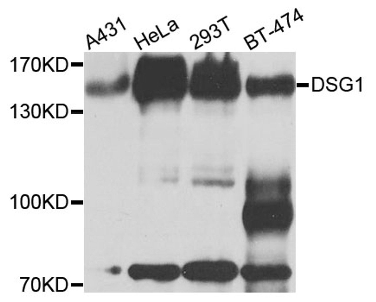Western blot analysis of extracts of various cell lines, using DSG1 antibody (23-917) at 1:1000 dilution.<br/>Secondary antibody: HRP Goat Anti-Rabbit IgG (H+L) at 1:10000 dilution.<br/>Lysates/proteins: 25ug per lane.<br/>Blocking buffer: 3% nonfat dry milk in TBST.<br/>Detection: ECL Basic Kit.<br/>Exposure time: 30s.