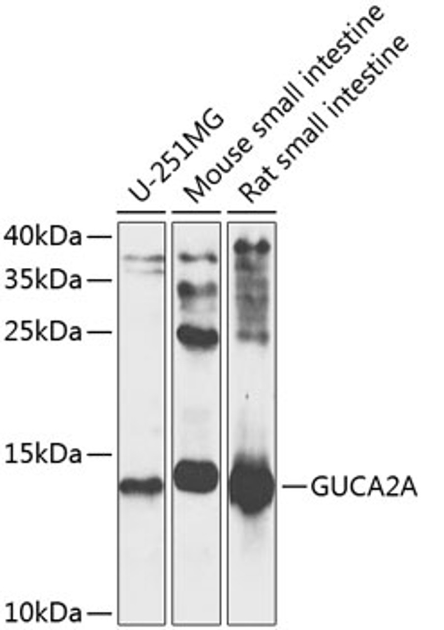 Western blot analysis of extracts of various cell lines, using GUCA2A antibody (23-921) at 1:1000 dilution._Secondary antibody: HRP Goat Anti-Rabbit IgG (H+L) at 1:10000 dilution._Lysates/proteins: 25ug per lane._Blocking buffer: 3% nonfat dry milk in TBST._Detection: ECL Enhanced Kit._Exposure time: 5s.