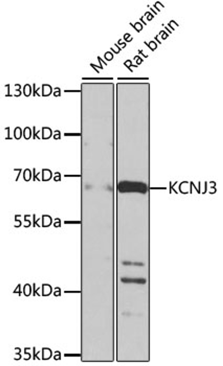 Western blot analysis of extracts of various cell lines, using KCNJ3 antibody (23-925) at 1:1000 dilution.<br/>Secondary antibody: HRP Goat Anti-Rabbit IgG (H+L) at 1:10000 dilution.<br/>Lysates/proteins: 25ug per lane.<br/>Blocking buffer: 3% nonfat dry milk in TBST.<br/>Detection: ECL Enhanced Kit.<br/>Exposure time: 10s.