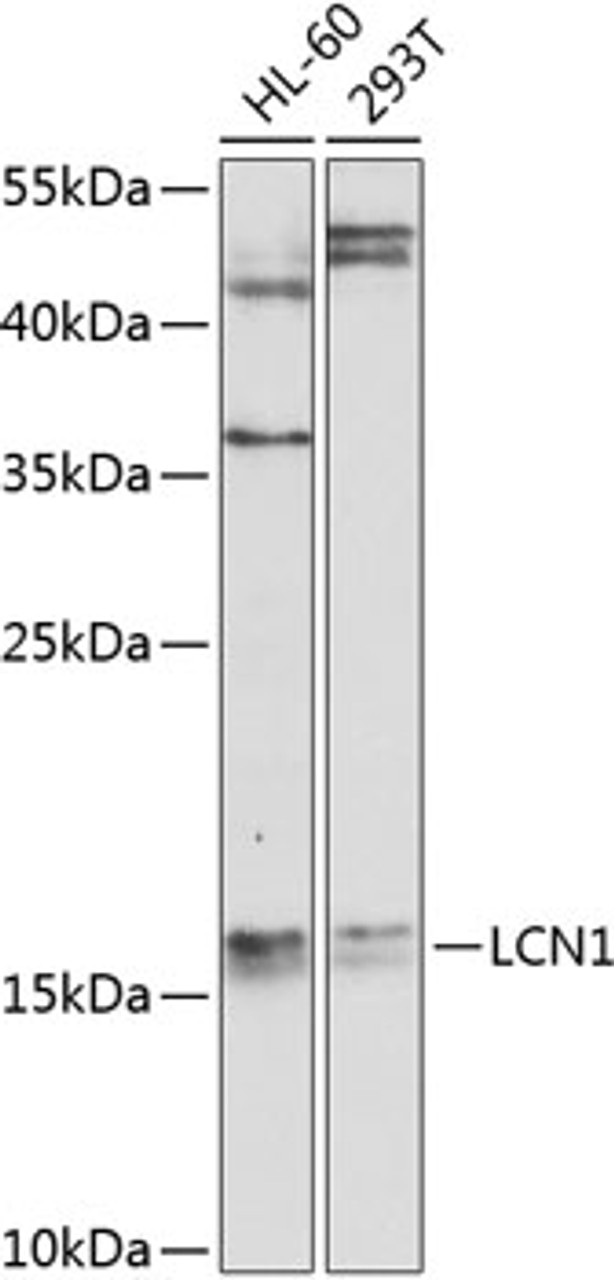 Western blot analysis of extracts of various cell lines, using LCN1 antibody (23-928) at 1:1000 dilution.<br/>Secondary antibody: HRP Goat Anti-Rabbit IgG (H+L) at 1:10000 dilution.<br/>Lysates/proteins: 25ug per lane.<br/>Blocking buffer: 3% nonfat dry milk in TBST.<br/>Detection: ECL Basic Kit.<br/>Exposure time: 90s.