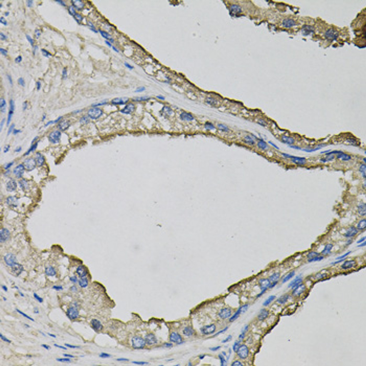 Immunohistochemistry of paraffin-embedded human prostate using LCN1 antibody (23-928) at dilution of 1:100 (40x lens) .