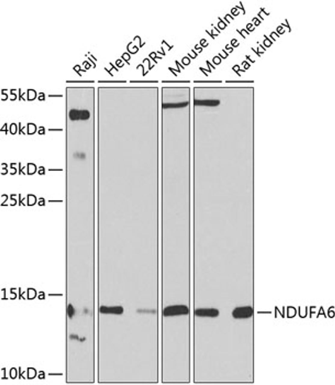 Western blot analysis of extracts of various cell lines, using NDUFA6 antibody (23-930) at 1:1000 dilution.<br/>Secondary antibody: HRP Goat Anti-Rabbit IgG (H+L) at 1:10000 dilution.<br/>Lysates/proteins: 25ug per lane.<br/>Blocking buffer: 3% nonfat dry milk in TBST.<br/>Detection: ECL Basic Kit.<br/>Exposure time: 90s.