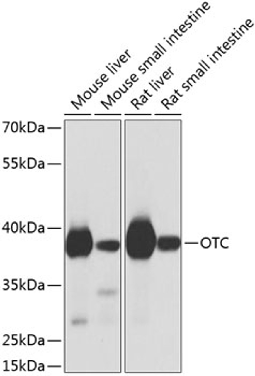 Western blot analysis of extracts of various cell lines, using OTC antibody (23-932) at 1:1000 dilution.<br/>Secondary antibody: HRP Goat Anti-Rabbit IgG (H+L) at 1:10000 dilution.<br/>Lysates/proteins: 25ug per lane.<br/>Blocking buffer: 3% nonfat dry milk in TBST.<br/>Detection: ECL Basic Kit.<br/>Exposure time: 1s.