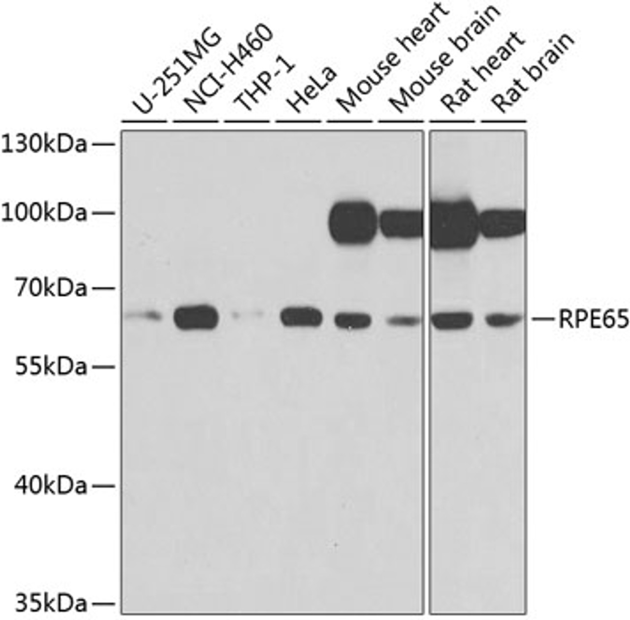 Western blot analysis of extracts of various cell lines, using RPE65 antibody (23-937) at 1:1000 dilution.<br/>Secondary antibody: HRP Goat Anti-Rabbit IgG (H+L) at 1:10000 dilution.<br/>Lysates/proteins: 25ug per lane.<br/>Blocking buffer: 3% nonfat dry milk in TBST.<br/>Detection: ECL Basic Kit.<br/>Exposure time: 5s.