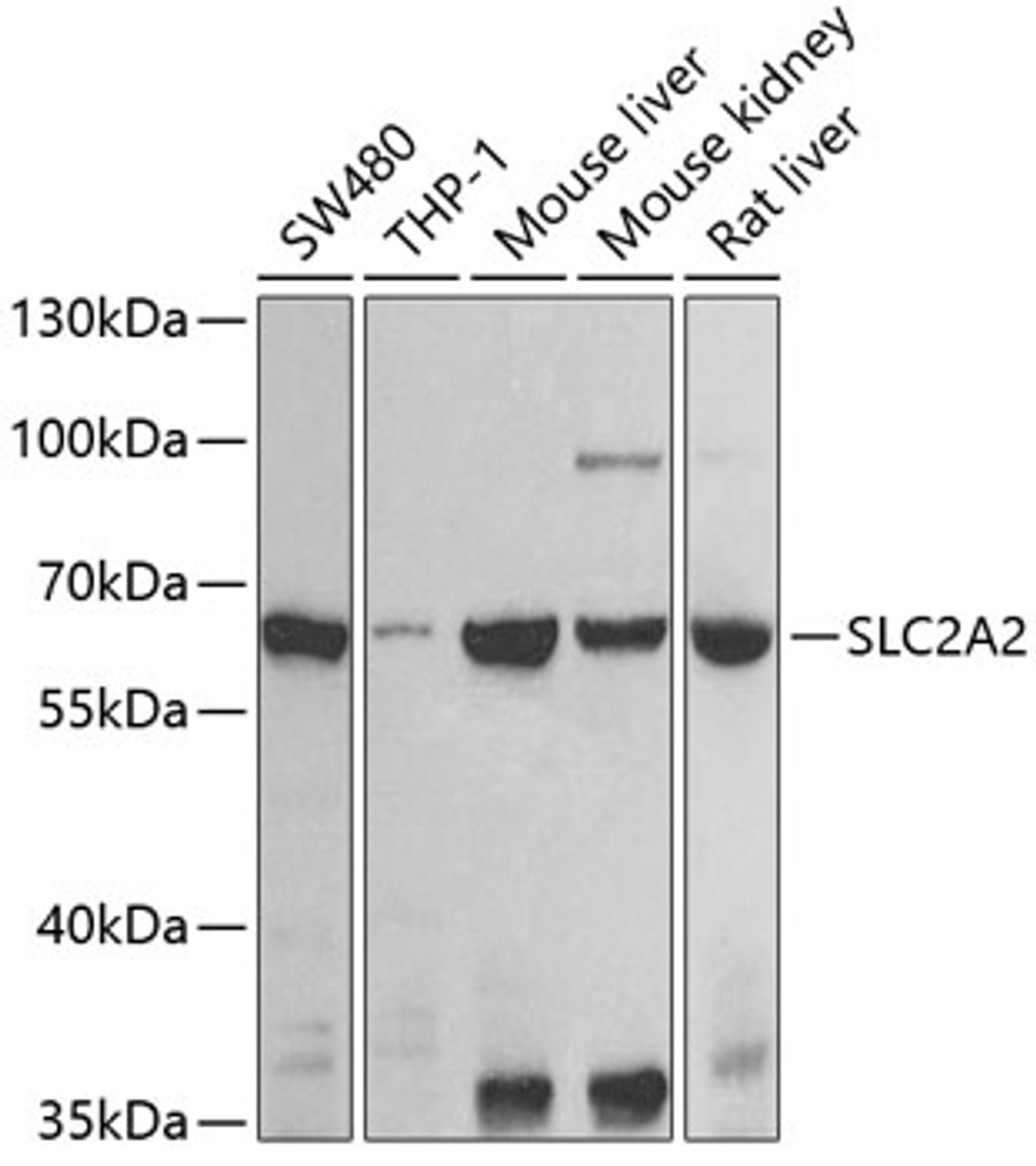 Western blot analysis of extracts of various cell lines, using SLC2A2 antibody (23-939) at 1:1000 dilution.<br/>Secondary antibody: HRP Goat Anti-Rabbit IgG (H+L) at 1:10000 dilution.<br/>Lysates/proteins: 25ug per lane.<br/>Blocking buffer: 3% nonfat dry milk in TBST.<br/>Detection: ECL Basic Kit.<br/>Exposure time: 90s.