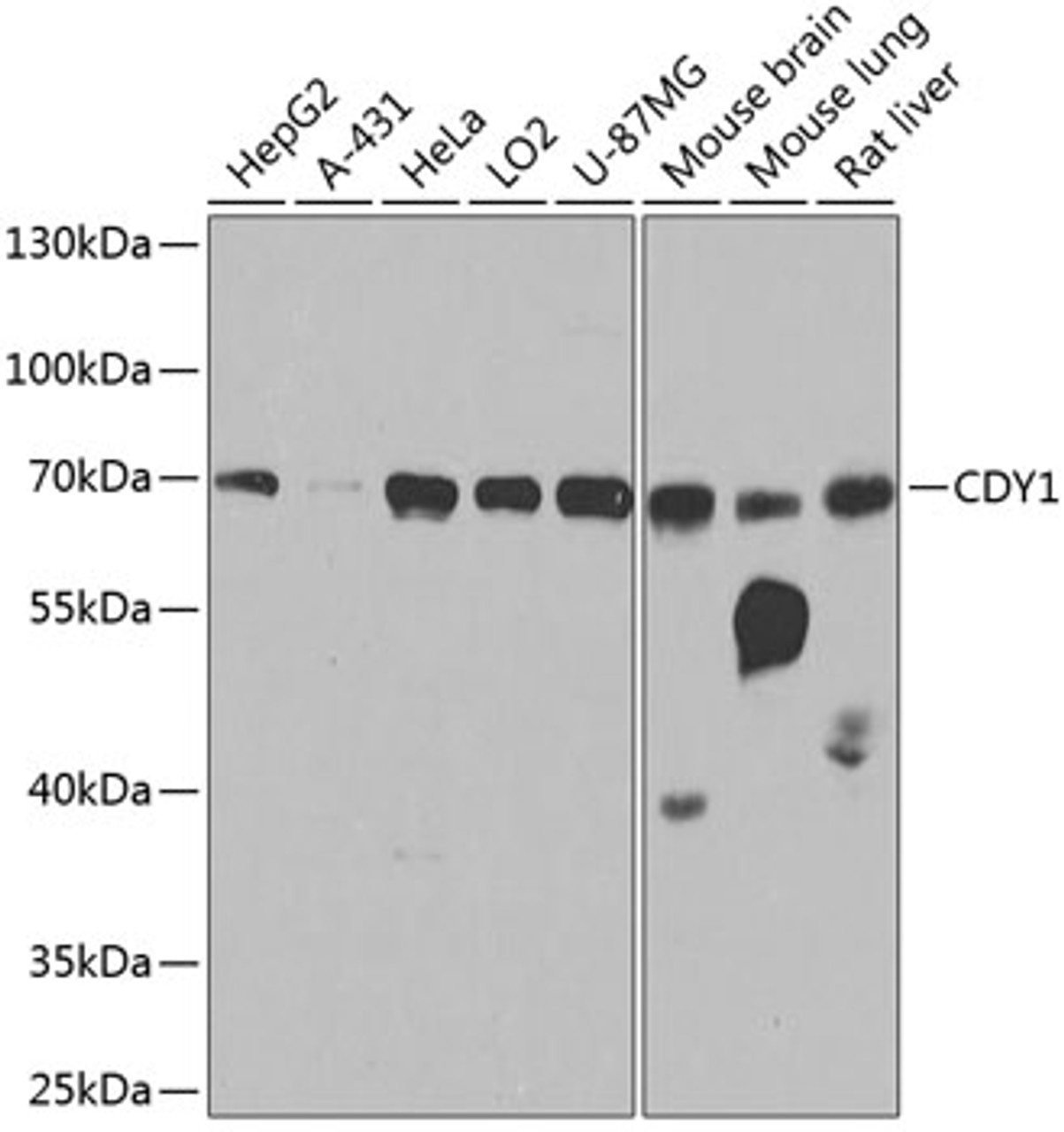 Western blot analysis of extracts of various cell lines, using CDY1 antibody (23-943) at 1:1000 dilution.<br/>Secondary antibody: HRP Goat Anti-Rabbit IgG (H+L) at 1:10000 dilution.<br/>Lysates/proteins: 25ug per lane.<br/>Blocking buffer: 3% nonfat dry milk in TBST.<br/>Detection: ECL Basic Kit.<br/>Exposure time: 30s.