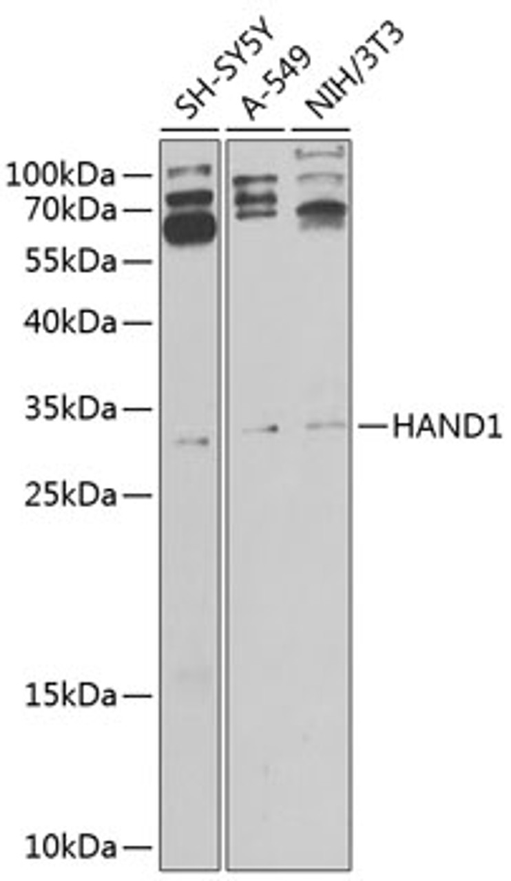 Western blot analysis of extracts of various cell lines, using HAND1 antibody (23-944) at 1:1000 dilution.<br/>Secondary antibody: HRP Goat Anti-Rabbit IgG (H+L) at 1:10000 dilution.<br/>Lysates/proteins: 25ug per lane.<br/>Blocking buffer: 3% nonfat dry milk in TBST.<br/>Detection: ECL Basic Kit.<br/>Exposure time: 5s.