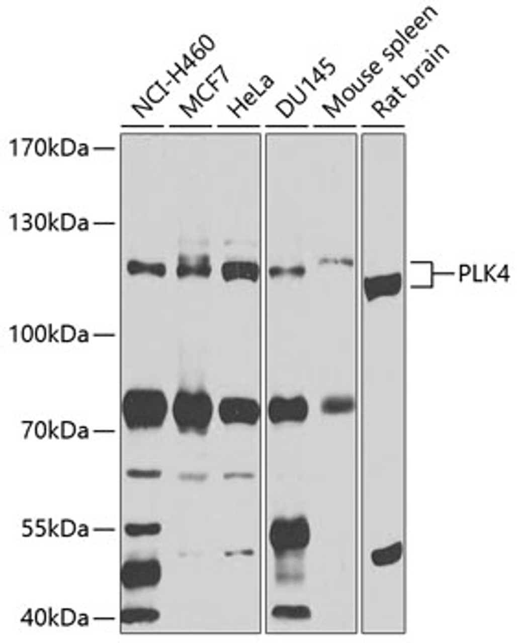 Western blot analysis of extracts of various cell lines, using PLK4 antibody (23-947) at 1:1000 dilution.<br/>Secondary antibody: HRP Goat Anti-Rabbit IgG (H+L) at 1:10000 dilution.<br/>Lysates/proteins: 25ug per lane.<br/>Blocking buffer: 3% nonfat dry milk in TBST.<br/>Detection: ECL Basic Kit.<br/>Exposure time: 15s.