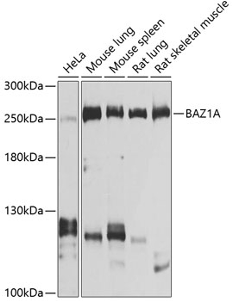 Western blot analysis of extracts of various cell lines, using BAZ1A antibody (23-948) at 1:1000 dilution.<br/>Secondary antibody: HRP Goat Anti-Rabbit IgG (H+L) at 1:10000 dilution.<br/>Lysates/proteins: 25ug per lane.<br/>Blocking buffer: 3% nonfat dry milk in TBST.<br/>Detection: ECL Basic Kit.<br/>Exposure time: 1s.