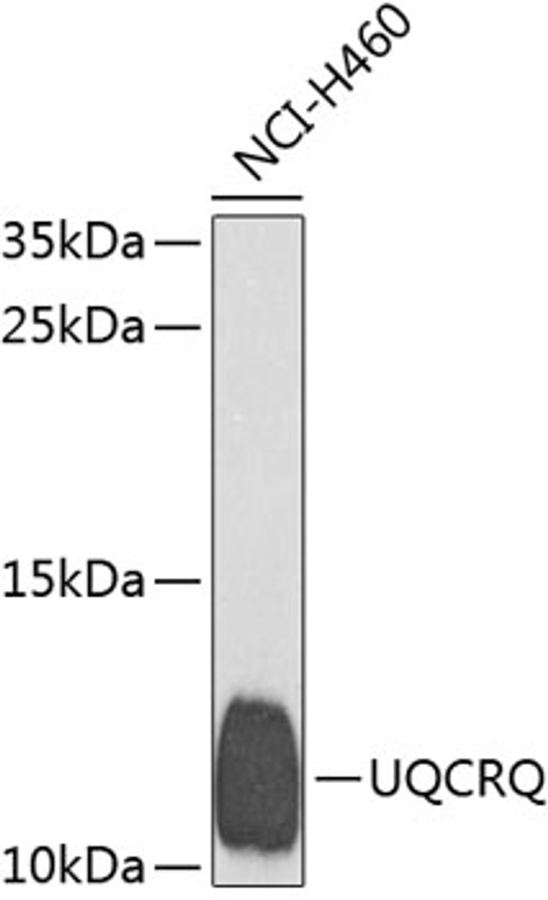 Western blot analysis of extracts of H460 cells, using UQCRQ antibody (23-950) at 1:1000 dilution.<br/>Secondary antibody: HRP Goat Anti-Rabbit IgG (H+L) at 1:10000 dilution.<br/>Lysates/proteins: 25ug per lane.<br/>Blocking buffer: 3% nonfat dry milk in TBST.<br/>Detection: ECL Basic Kit.<br/>Exposure time: 60s.