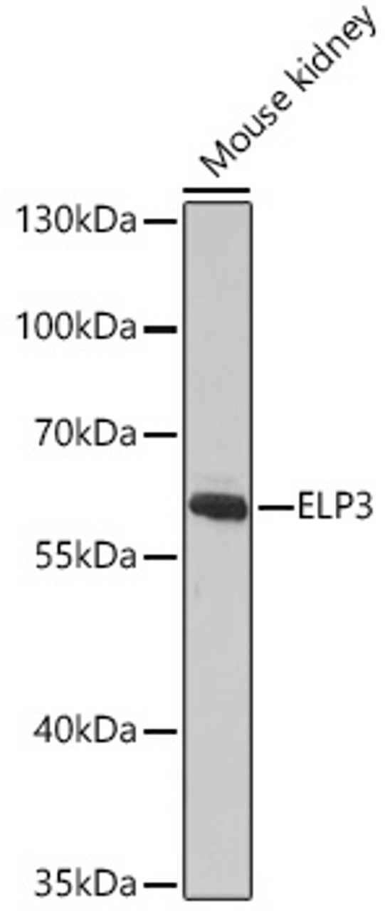 Western blot analysis of extracts of Mouse kidney, using ELP3 antibody (23-954) at 1:1000 dilution.<br/>Secondary antibody: HRP Goat Anti-Rabbit IgG (H+L) at 1:10000 dilution.<br/>Lysates/proteins: 25ug per lane.<br/>Blocking buffer: 3% nonfat dry milk in TBST.<br/>Detection: ECL Basic Kit.<br/>Exposure time: 120s.