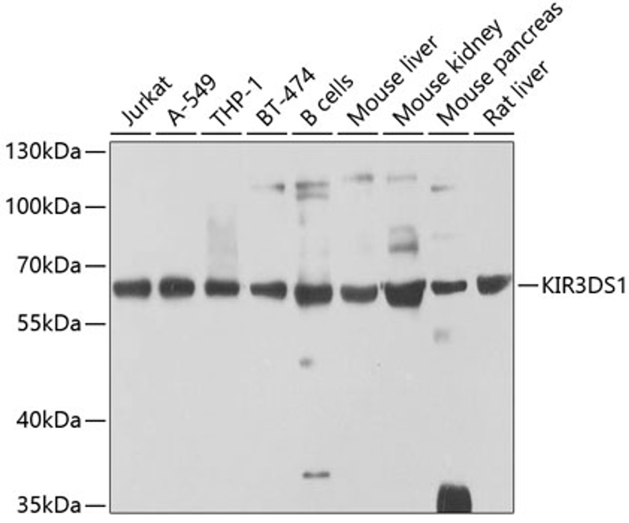 Western blot analysis of extracts of various cell lines, using KIR3DS1 antibody (23-984) at 1:1000 dilution.<br/>Secondary antibody: HRP Goat Anti-Rabbit IgG (H+L) at 1:10000 dilution.<br/>Lysates/proteins: 25ug per lane.<br/>Blocking buffer: 3% nonfat dry milk in TBST.<br/>Detection: ECL Basic Kit.<br/>Exposure time: 60s.