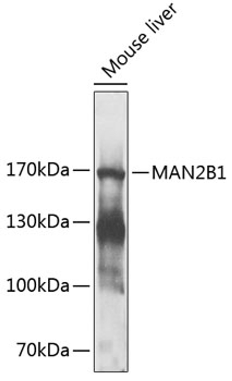 Western blot analysis of extracts of mouse liver, using MAN2B1 antibody (23-985) at 1:1000 dilution.<br/>Secondary antibody: HRP Goat Anti-Rabbit IgG (H+L) at 1:10000 dilution.<br/>Lysates/proteins: 25ug per lane.<br/>Blocking buffer: 3% nonfat dry milk in TBST.<br/>Detection: ECL Enhanced Kit.<br/>Exposure time: 30s.