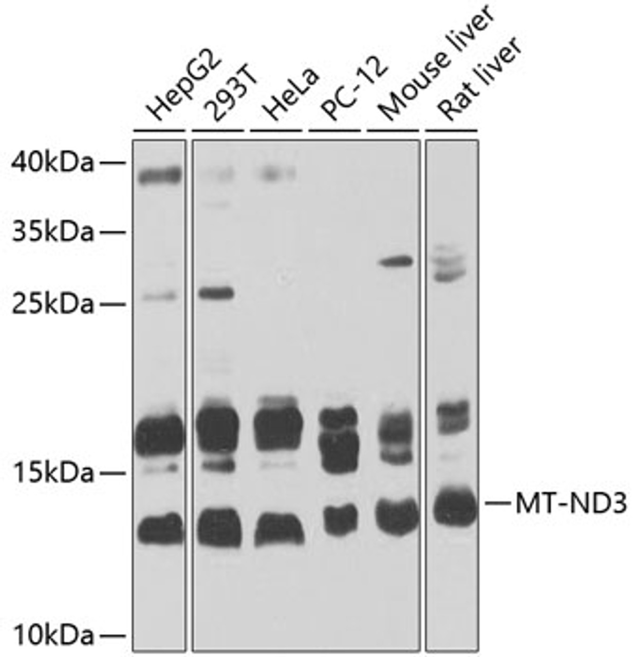 Western blot analysis of extracts of various cell lines, using MT-ND3 Antibody (23-987) at 1:1000 dilution.<br/>Secondary antibody: HRP Goat Anti-Rabbit IgG (H+L) at 1:10000 dilution.<br/>Lysates/proteins: 25ug per lane.<br/>Blocking buffer: 3% nonfat dry milk in TBST.<br/>Detection: ECL Basic Kit.<br/>Exposure time: 30s.