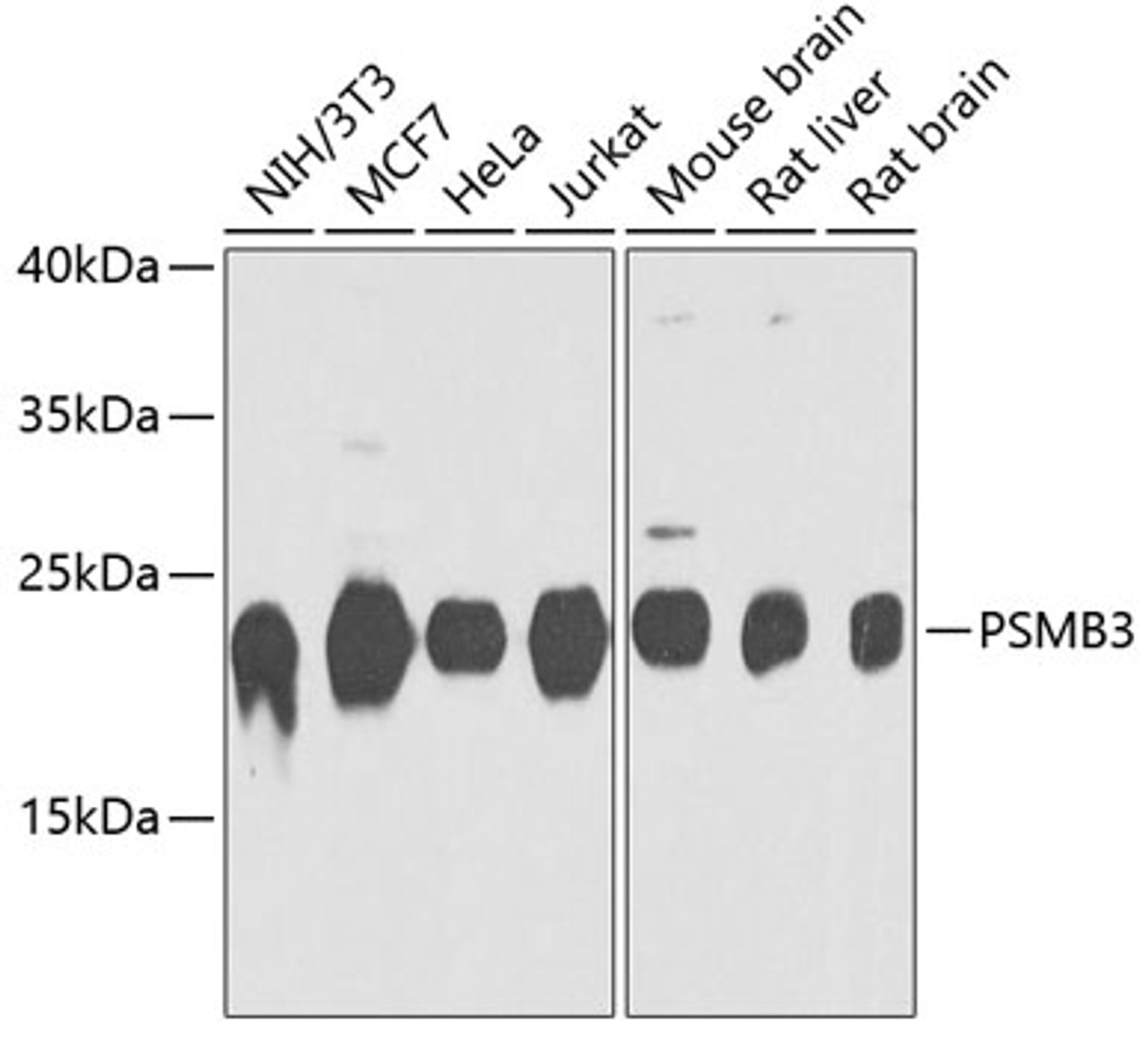 Western blot analysis of extracts of various cell lines, using PSMB3 antibody (23-992) at 1:1000 dilution.<br/>Secondary antibody: HRP Goat Anti-Rabbit IgG (H+L) at 1:10000 dilution.<br/>Lysates/proteins: 25ug per lane.<br/>Blocking buffer: 3% nonfat dry milk in TBST.<br/>Detection: ECL Basic Kit.<br/>Exposure time: 90s.