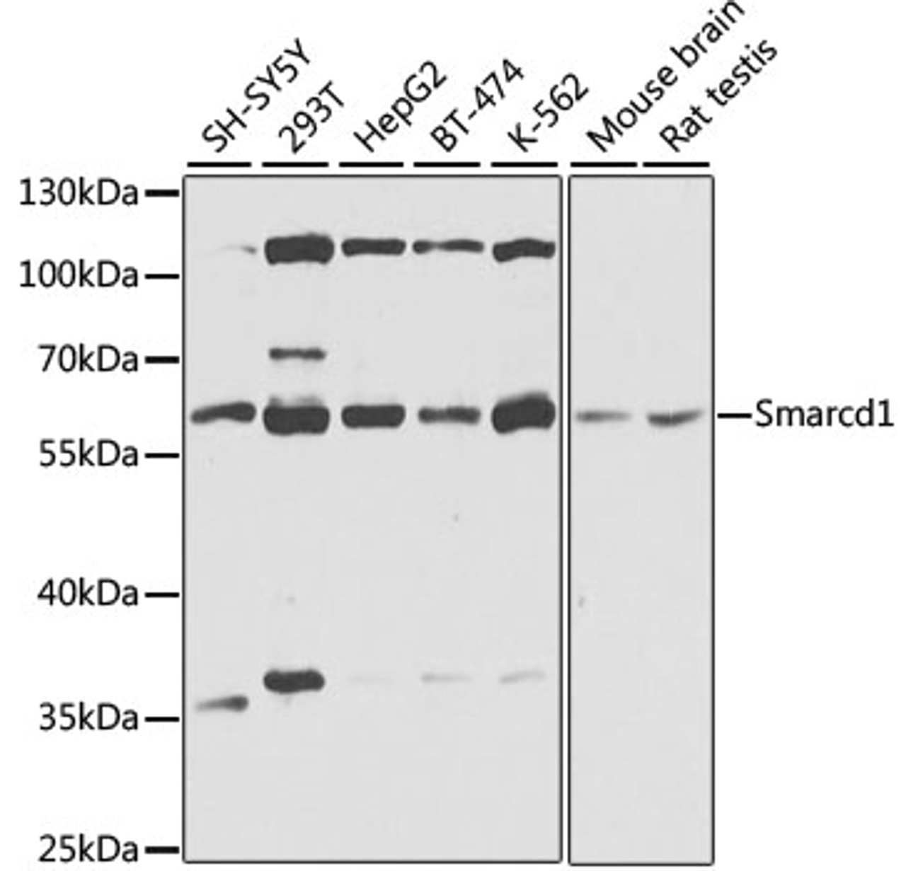 Western blot analysis of extracts of various cell lines, using Smarcd1 antibody (23-994) at 1:1000 dilution.<br/>Secondary antibody: HRP Goat Anti-Rabbit IgG (H+L) at 1:10000 dilution.<br/>Lysates/proteins: 25ug per lane.<br/>Blocking buffer: 3% nonfat dry milk in TBST.<br/>Detection: ECL Basic Kit.<br/>Exposure time: 15s.