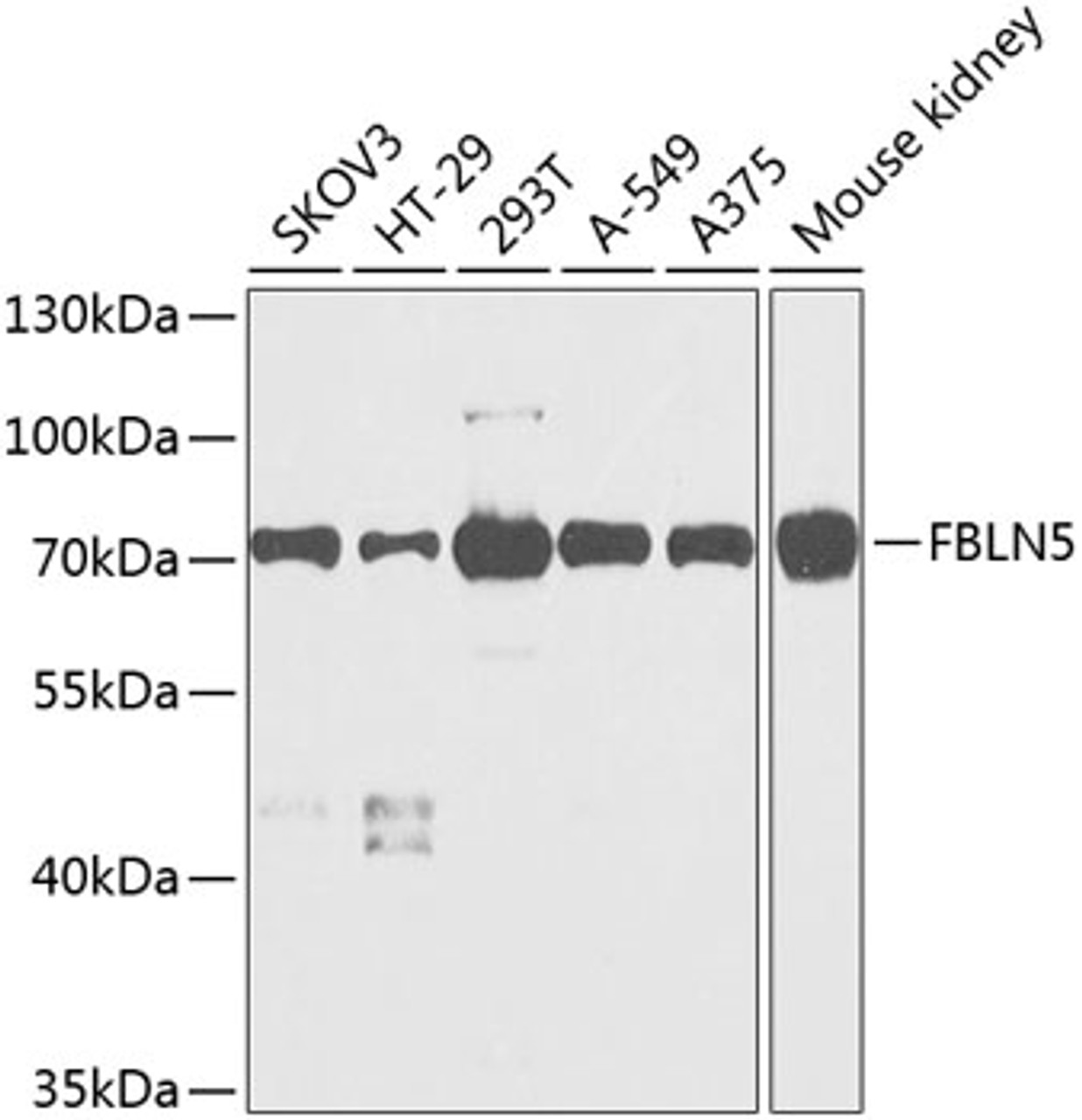 Western blot analysis of extracts of various cell lines, using FBLN5 antibody (23-998) at 1:1000 dilution.<br/>Secondary antibody: HRP Goat Anti-Rabbit IgG (H+L) at 1:10000 dilution.<br/>Lysates/proteins: 25ug per lane.<br/>Blocking buffer: 3% nonfat dry milk in TBST.<br/>Detection: ECL Basic Kit.<br/>Exposure time: 60s.