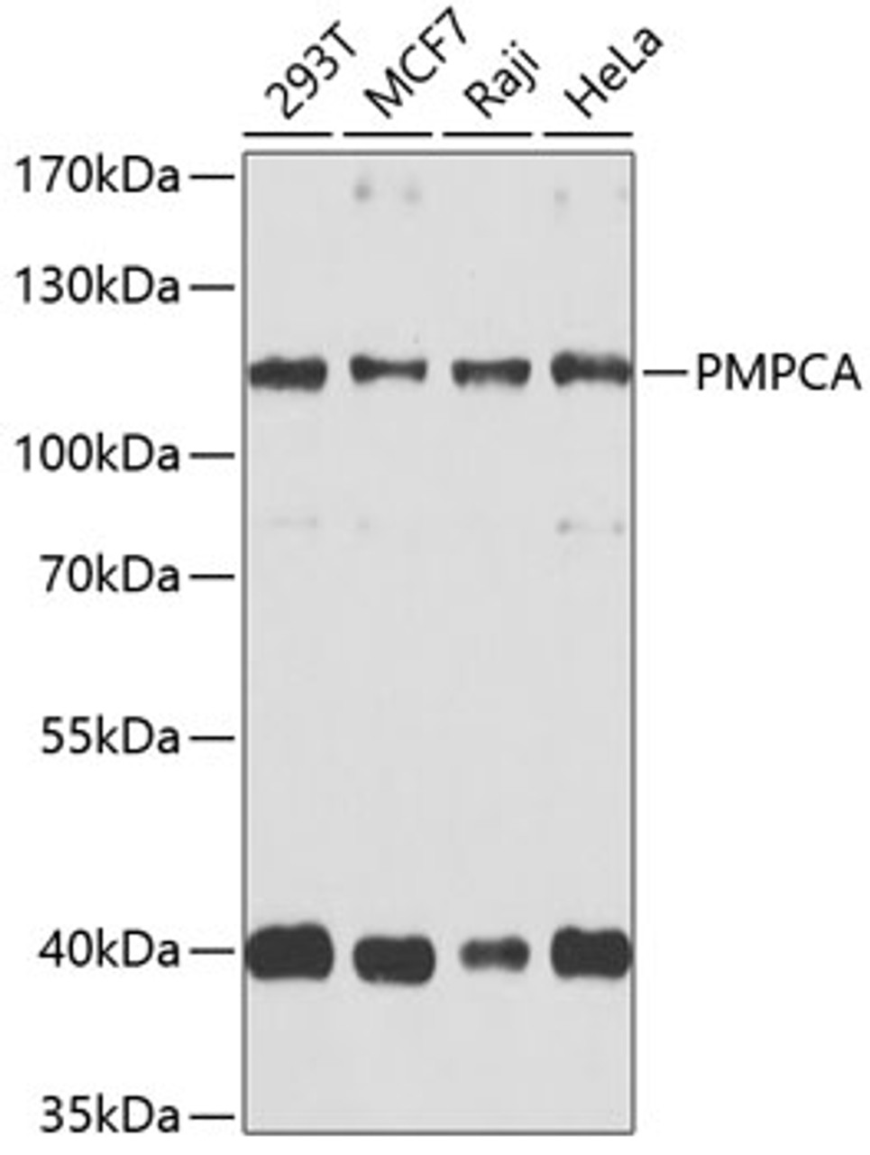 Western blot analysis of extracts of various cell lines, using PMPCA antibody (24-001) at 1:1000 dilution.<br/>Secondary antibody: HRP Goat Anti-Rabbit IgG (H+L) at 1:10000 dilution.<br/>Lysates/proteins: 25ug per lane.<br/>Blocking buffer: 3% nonfat dry milk in TBST.<br/>Detection: ECL Basic Kit.<br/>Exposure time: 30s.