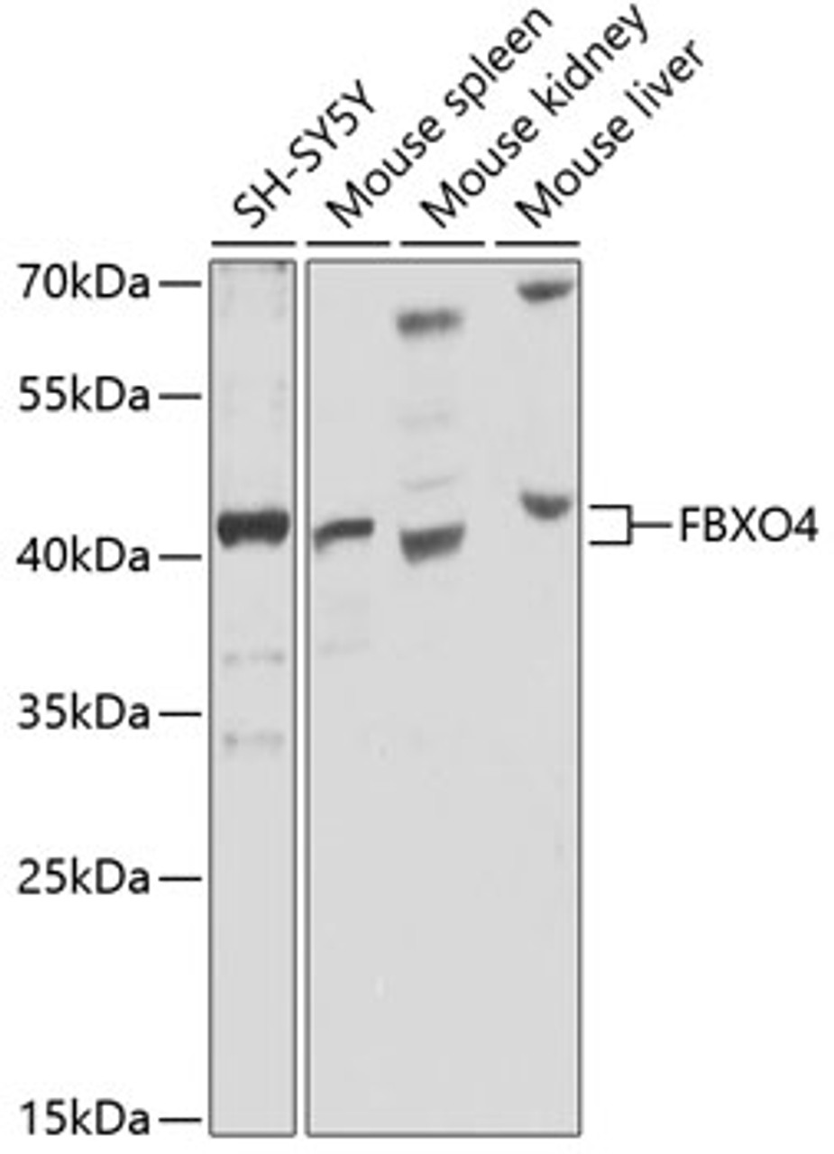 Western blot analysis of extracts of various cell lines, using FBXO4 antibody (24-002) at 1:1000 dilution.<br/>Secondary antibody: HRP Goat Anti-Rabbit IgG (H+L) at 1:10000 dilution.<br/>Lysates/proteins: 25ug per lane.<br/>Blocking buffer: 3% nonfat dry milk in TBST.<br/>Detection: ECL Basic Kit.<br/>Exposure time: 15s.