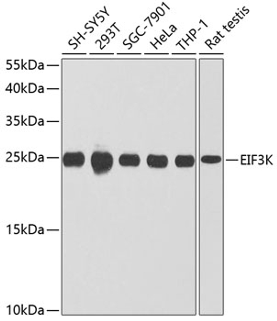 Western blot analysis of extracts of various cell lines, using EIF3K antibody (24-003) at 1:1000 dilution.<br/>Secondary antibody: HRP Goat Anti-Rabbit IgG (H+L) at 1:10000 dilution.<br/>Lysates/proteins: 25ug per lane.<br/>Blocking buffer: 3% nonfat dry milk in TBST.<br/>Detection: ECL Basic Kit.<br/>Exposure time: 90s.
