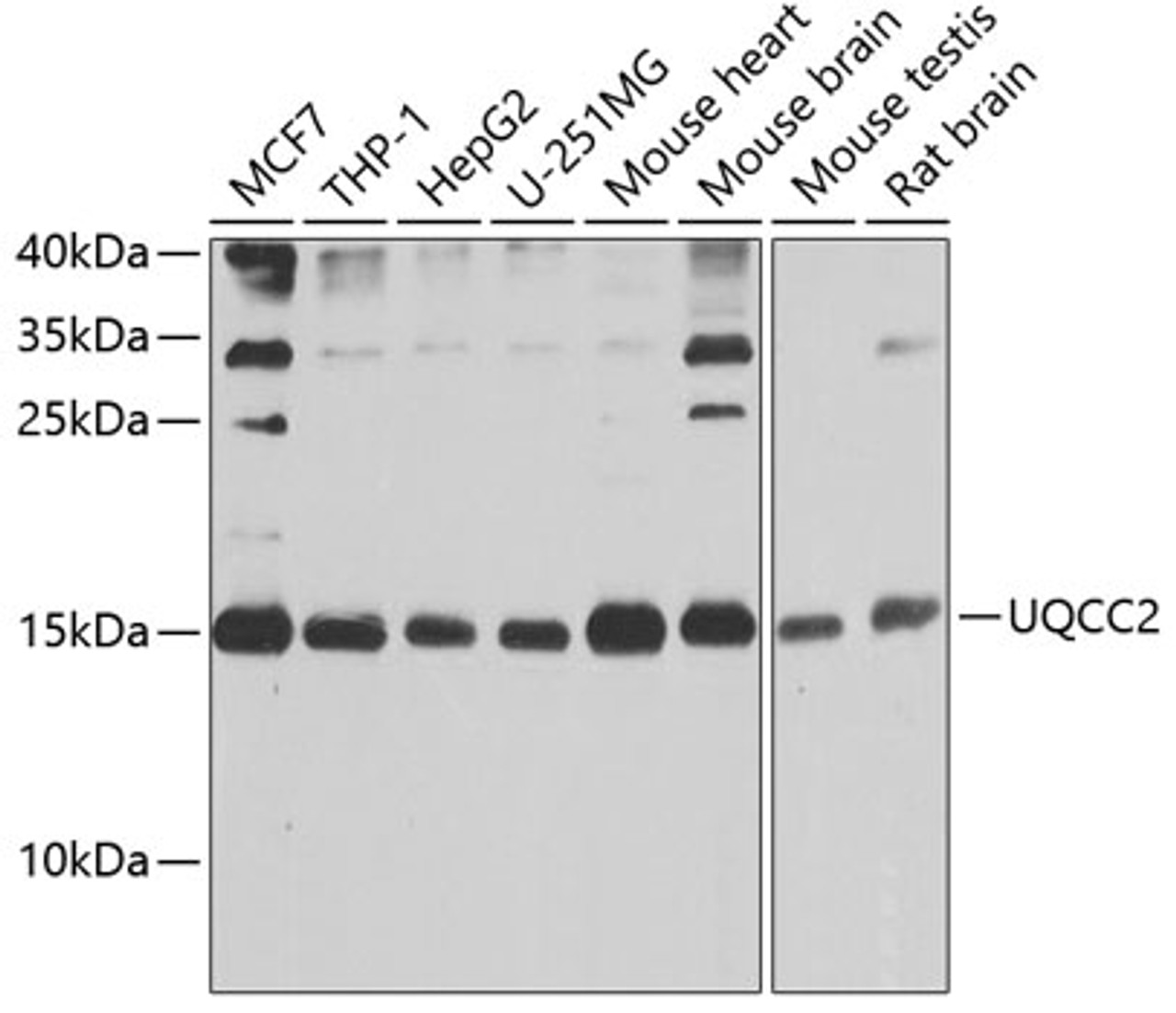 Western blot analysis of extracts of various cell lines, using UQCC2 antibody (24-014) at 1:1000 dilution.<br/>Secondary antibody: HRP Goat Anti-Rabbit IgG (H+L) at 1:10000 dilution.<br/>Lysates/proteins: 25ug per lane.<br/>Blocking buffer: 3% nonfat dry milk in TBST.<br/>Detection: ECL Basic Kit.<br/>Exposure time: 5s.