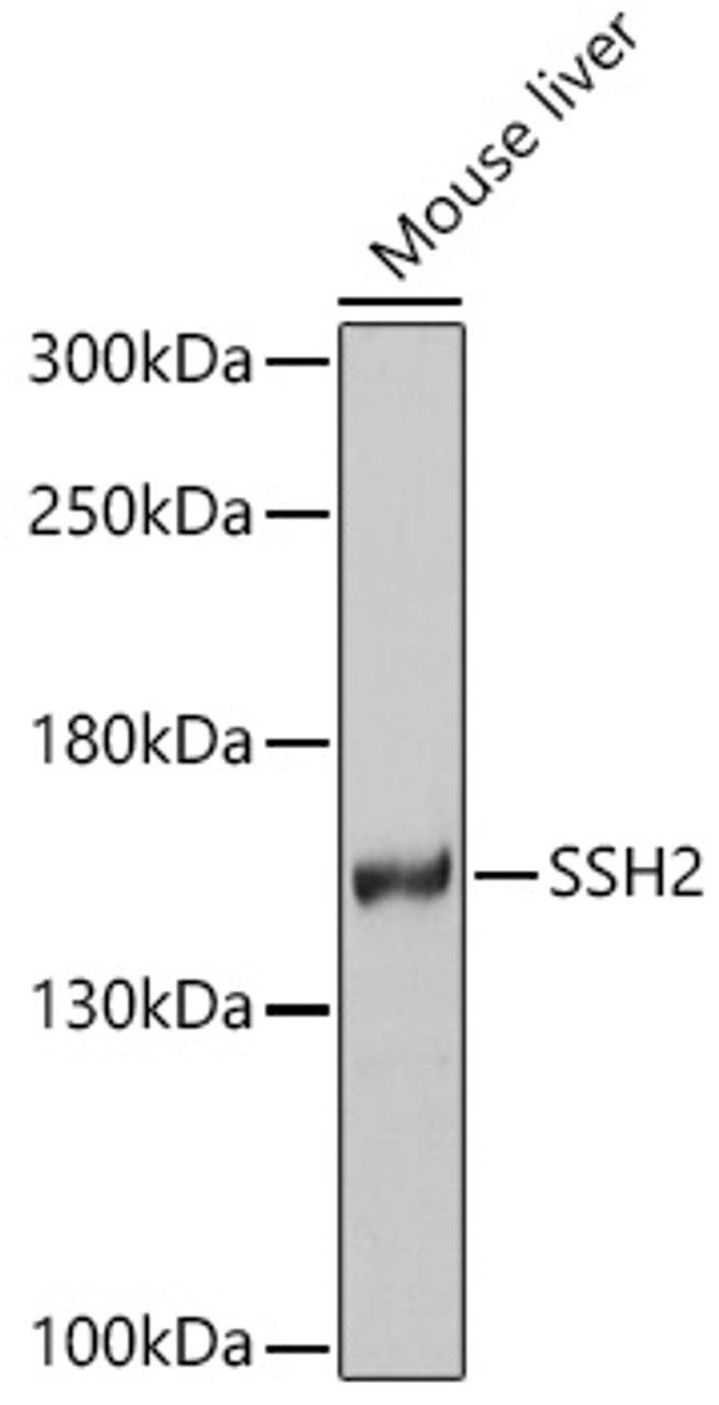 Western blot analysis of extracts of Mouse liver, using SSH2 antibody (24-016) at 1:1000 dilution.<br/>Secondary antibody: HRP Goat Anti-Rabbit IgG (H+L) at 1:10000 dilution.<br/>Lysates/proteins: 25ug per lane.<br/>Blocking buffer: 3% nonfat dry milk in TBST.<br/>Detection: ECL Basic Kit.<br/>Exposure time: 5min.