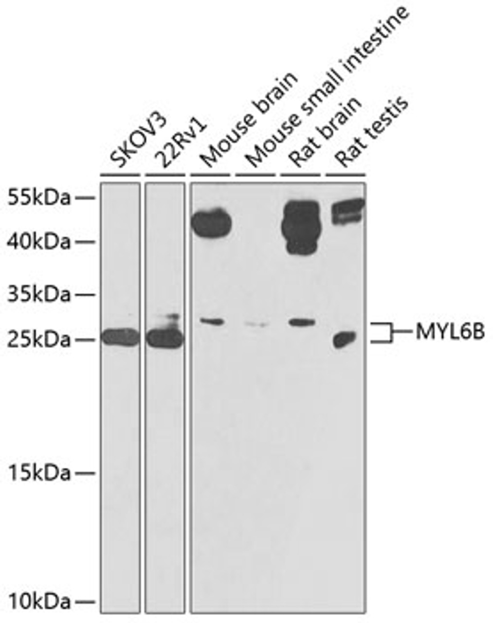 Western blot analysis of extracts of various cell lines, using MYL6B antibody (24-021) at 1:1000 dilution._Secondary antibody: HRP Goat Anti-Rabbit IgG (H+L) at 1:10000 dilution._Lysates/proteins: 25ug per lane._Blocking buffer: 3% nonfat dry milk in TBST._Detection: ECL Enhanced Kit._Exposure time: 90s.