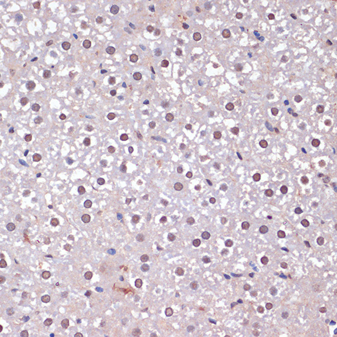 Immunohistochemistry of paraffin-embedded Rat liver using CDKN2A / p16INK4a antibody (24-023) at dilution of 1:100 (40x lens) .