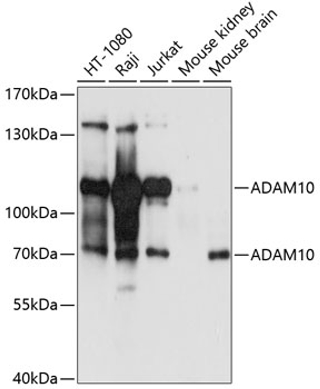 Western blot analysis of extracts of various cell lines, using ADAM10 antibody (24-024) at 1:1000 dilution.<br />Secondary antibody: HRP Goat Anti-Rabbit IgG (H+L) (AS014) at 1:10000 dilution.<br />Lysates/proteins: 25ug per lane.<br />Blocking buffer: 3% nonfat dry milk in TBST.<br />Detection: ECL Basic Kit<br />Exposure time: 30s.