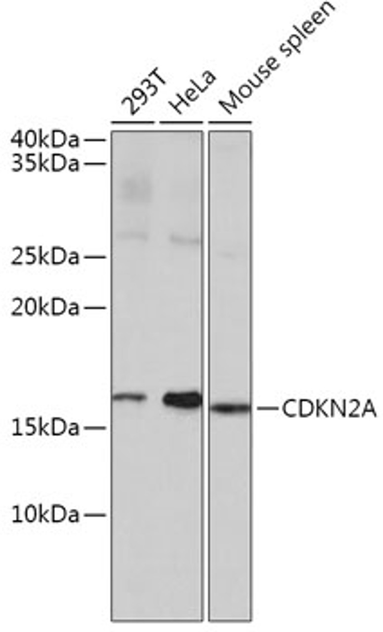 Western blot analysis of extracts of various cell lines, using CDKN2A antibody (24-026) at 1:1000 dilution.<br />Secondary antibody: HRP Goat Anti-Rabbit IgG (H+L) (AS014) at 1:10000 dilution.<br />Lysates/proteins: 25ug per lane.<br />Blocking buffer: 3% nonfat dry milk in TBST.<br />Detection: ECL Basic Kit.<br />Exposure time: 1s.