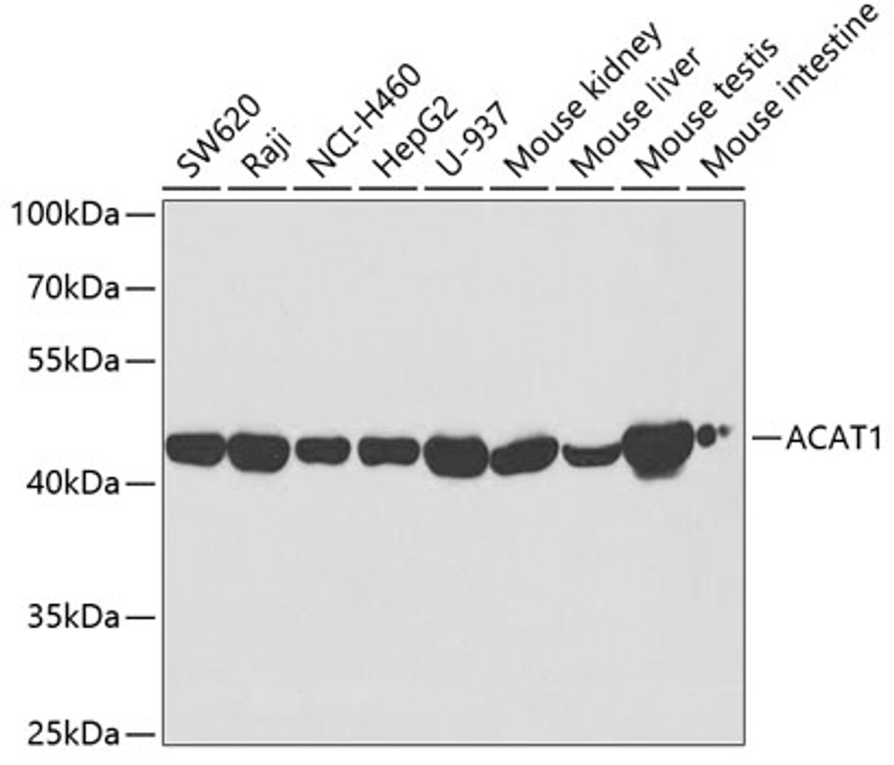 Western blot analysis of extracts of various cell lines, using ACAT1 antibody (19-597) at 1:5000 dilution.<br/>Secondary antibody: HRP Goat Anti-Rabbit IgG (H+L) at 1:10000 dilution.<br/>Lysates/proteins: 25ug per lane.<br/>Blocking buffer: 3% nonfat dry milk in TBST.<br/>Detection: ECL Basic Kit.<br/>Exposure time: 10s.