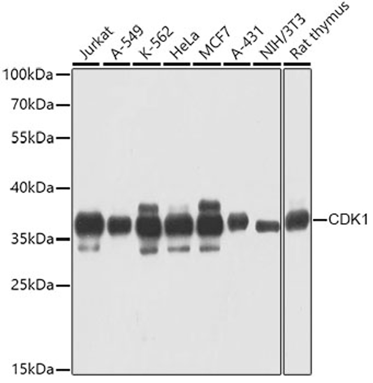 Western blot analysis of extracts of various cell lines, using CDK1 antibody (13-010) at 1:100 dilution.<br/>Secondary antibody: HRP Goat Anti-Mouse IgG (H+L) (AS003) at 1:10000 dilution.<br/>Lysates/proteins: 25ug per lane.<br/>Blocking buffer: 3% nonfat dry milk in TBST.<br/>Detection: ECL Basic Kit.<br/>Exposure time: 10s.