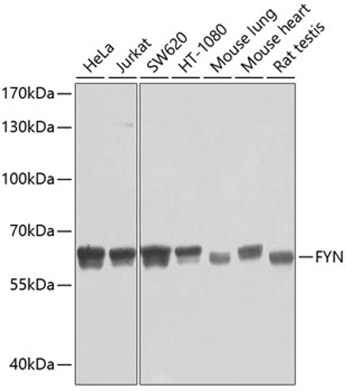Western blot analysis of extracts of various cell lines, using FYN antibody (13-026) at 1:500 dilution.<br/>Secondary antibody: HRP Goat Anti-Mouse IgG (H+L) (AS003) at 1:10000 dilution.<br/>Lysates/proteins: 25ug per lane.<br/>Blocking buffer: 3% nonfat dry milk in TBST.<br/>Detection: ECL Basic Kit.<br/>Exposure time: 60s.