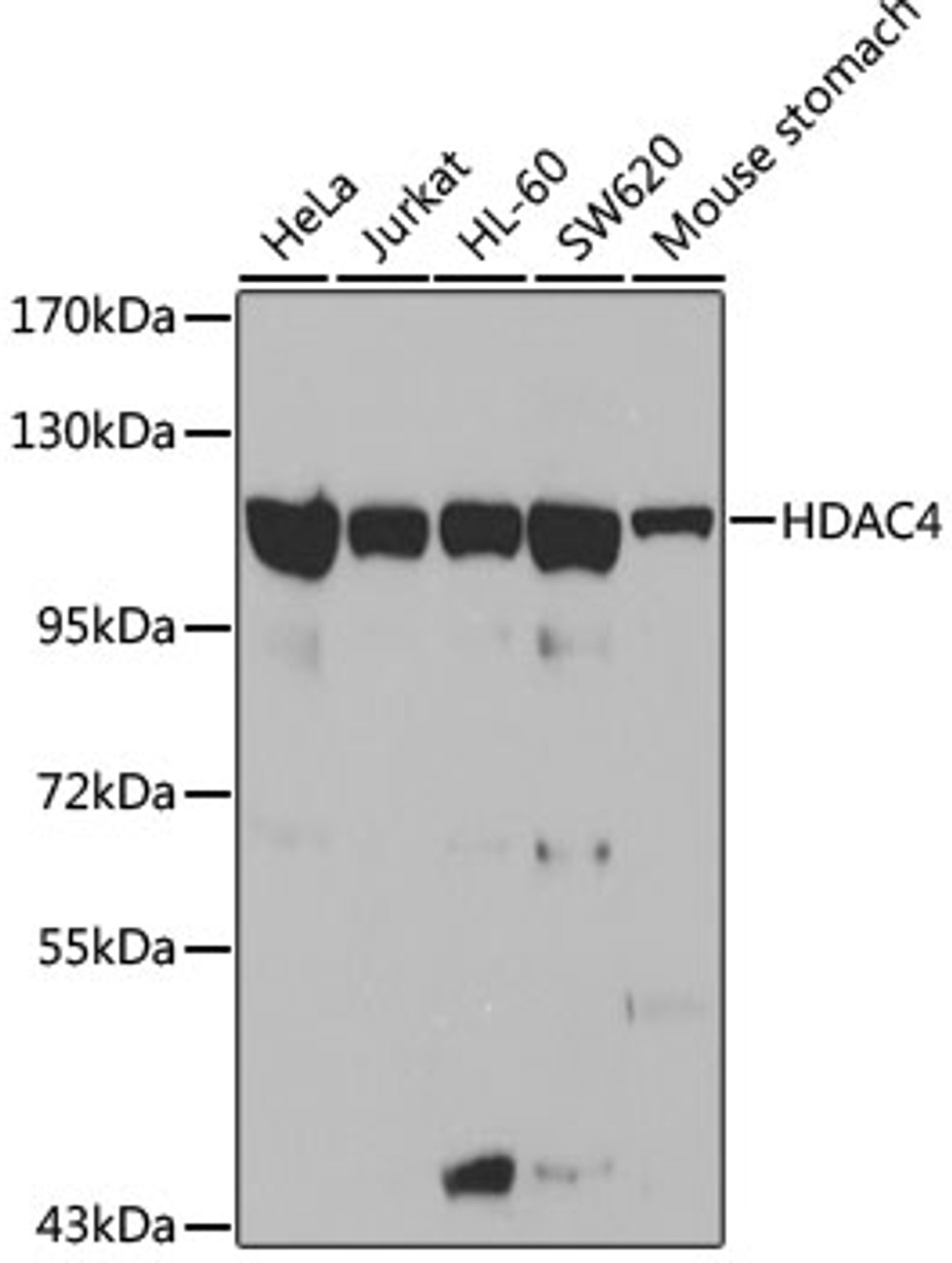 Western blot analysis of extracts of various cell lines, using HDAC4 antibody (13-099) at 1:1000 dilution.<br/>Secondary antibody: HRP Goat Anti-Rabbit IgG (H+L) at 1:10000 dilution.<br/>Lysates/proteins: 25ug per lane.<br/>Blocking buffer: 3% nonfat dry milk in TBST.