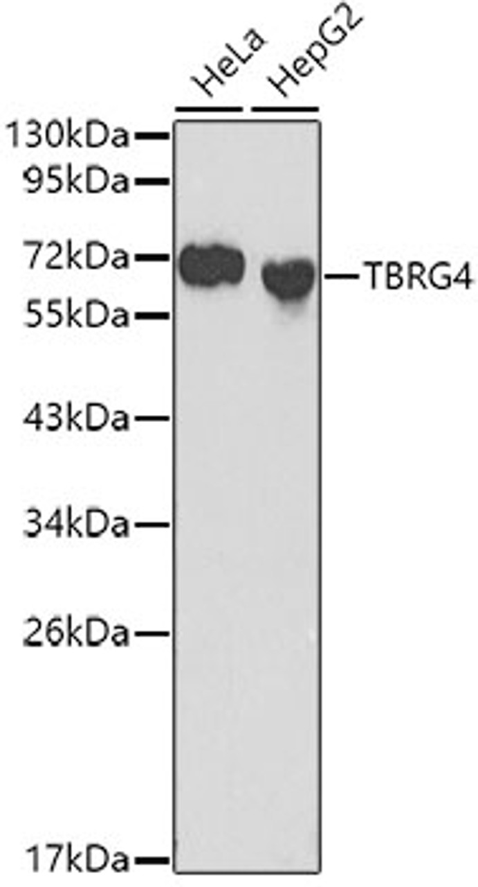 Western blot analysis of extracts of various cell lines, using TBRG4 antibody (13-122) at 1:1000 dilution.<br/>Secondary antibody: HRP Goat Anti-Rabbit IgG (H+L) at 1:10000 dilution.<br/>Lysates/proteins: 25ug per lane.<br/>Blocking buffer: 3% nonfat dry milk in TBST.