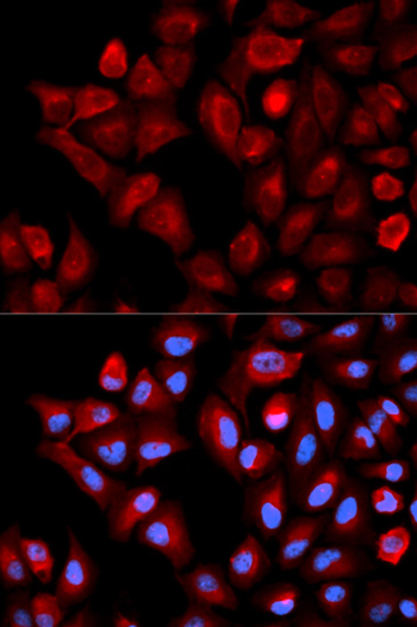 Immunofluorescence analysis of HeLa cells using TBRG4 antibody (13-122) . Blue: DAPI for nuclear staining.