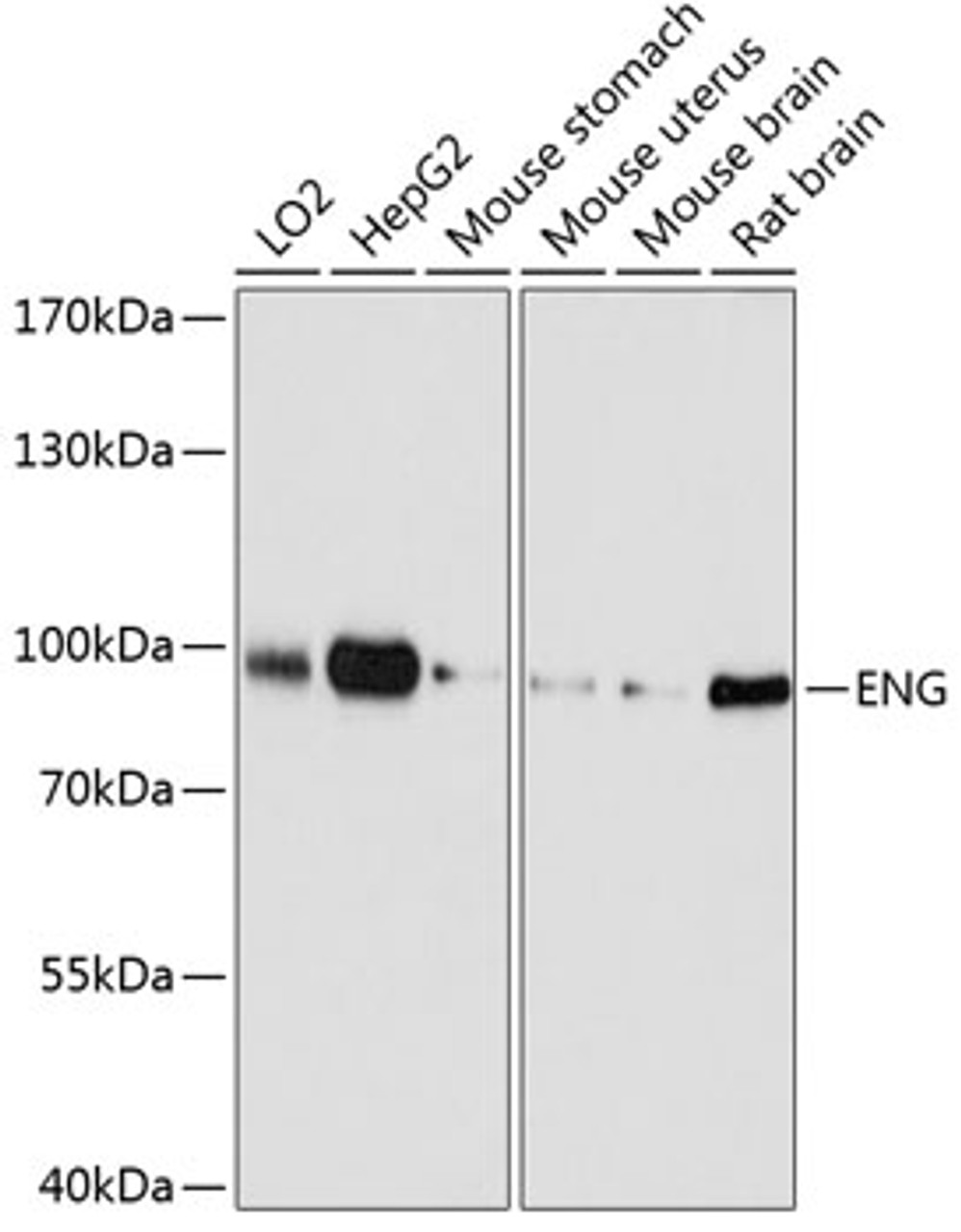 Western blot analysis of extracts of various cell lines, using ENG antibody (13-161) at 1:1000 dilution.<br/>Secondary antibody: HRP Goat Anti-Rabbit IgG (H+L) at 1:10000 dilution.<br/>Lysates/proteins: 25ug per lane.<br/>Blocking buffer: 3% nonfat dry milk in TBST.<br/>Detection: ECL Basic Kit.<br/>Exposure time: 90s.