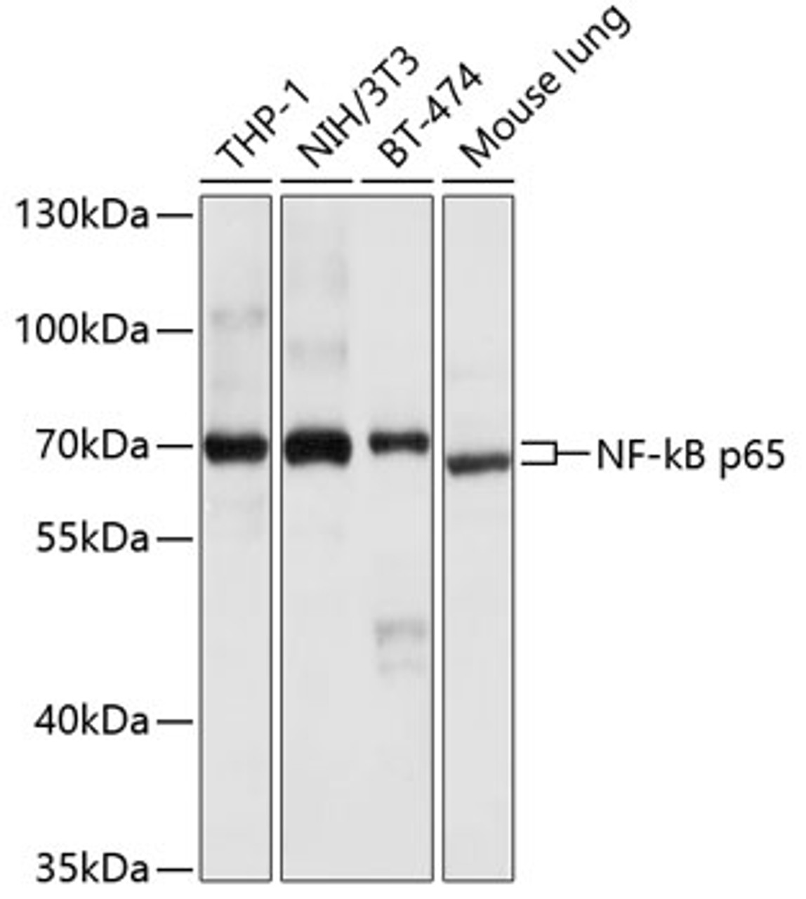 Western blot analysis of extracts of various cell lines, using NF-kB p65 antibody (13-175) at 1:1000 dilution.<br/>Secondary antibody: HRP Goat Anti-Rabbit IgG (H+L) at 1:10000 dilution.<br/>Lysates/proteins: 25ug per lane.<br/>Blocking buffer: 3% nonfat dry milk in TBST.<br/>Detection: ECL Basic Kit.<br/>Exposure time: 10s.