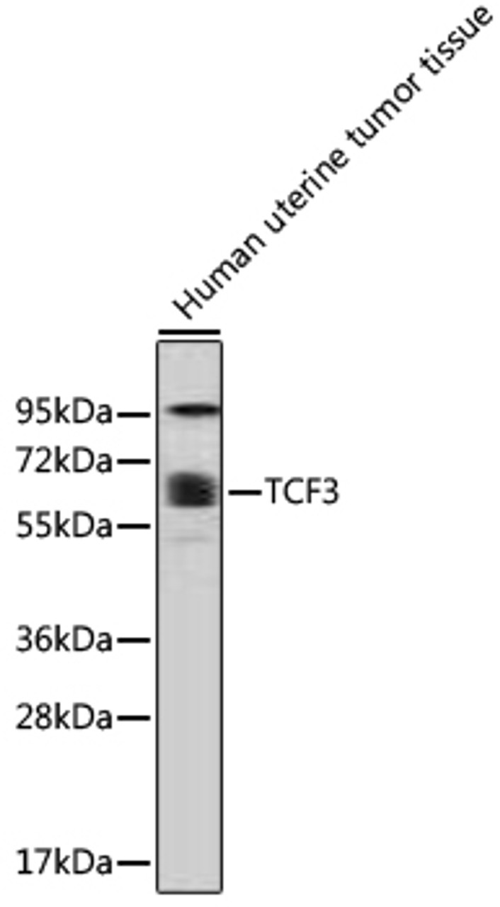 Western blot analysis of extracts of human uterine tumor tissue, using TCF3 antibody (13-191) at dilution.<br/>Secondary antibody: HRP Goat Anti-Rabbit IgG (H+L) at 1:10000 dilution.<br/>Lysates/proteins: 25ug per lane.<br/>Blocking buffer: 3% nonfat dry milk in TBST.