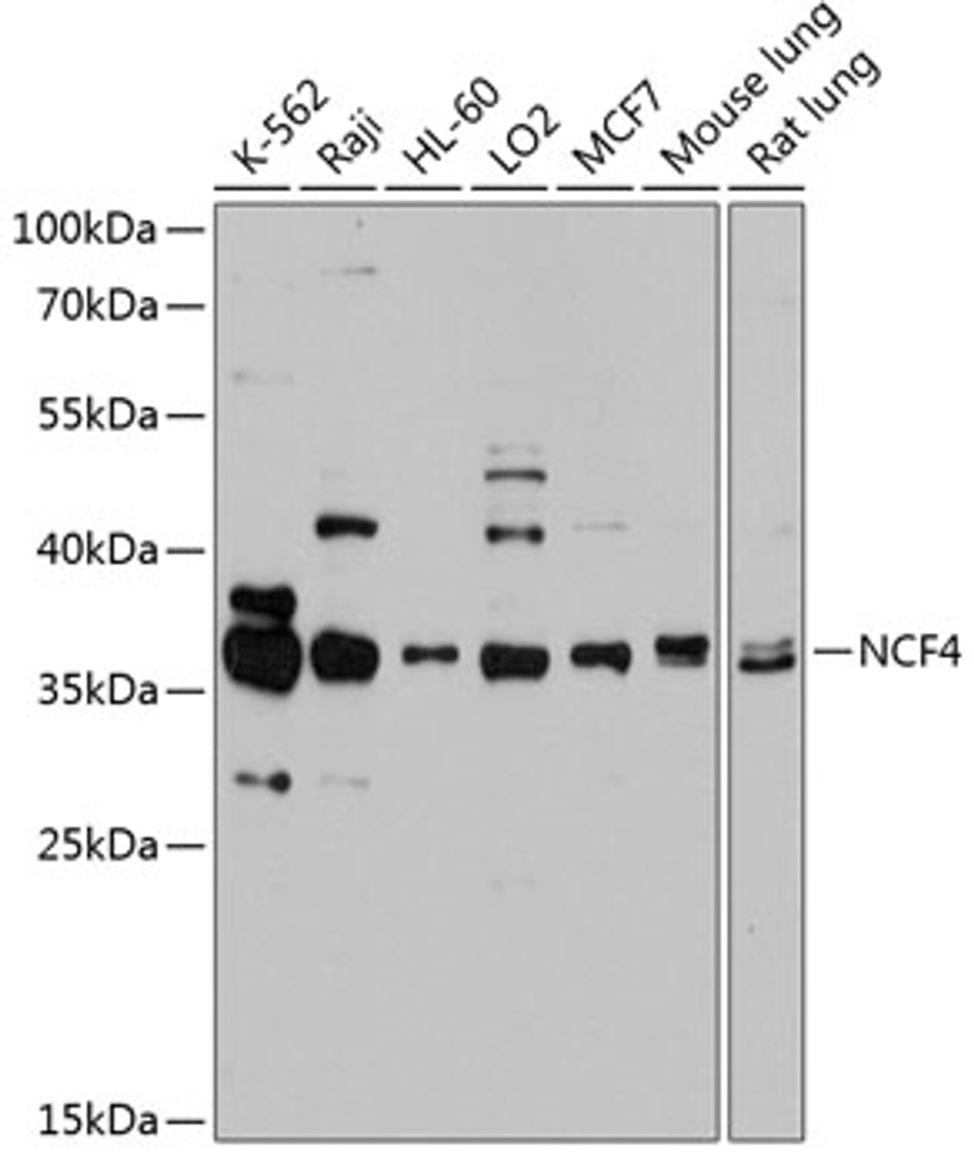 Western blot analysis of extracts of various cell lines, using NCF4 antibody (13-218) at 1:1000 dilution.<br/>Secondary antibody: HRP Goat Anti-Rabbit IgG (H+L) at 1:10000 dilution.<br/>Lysates/proteins: 25ug per lane.<br/>Blocking buffer: 3% nonfat dry milk in TBST.<br/>Detection: ECL Basic Kit.<br/>Exposure time: 40s.