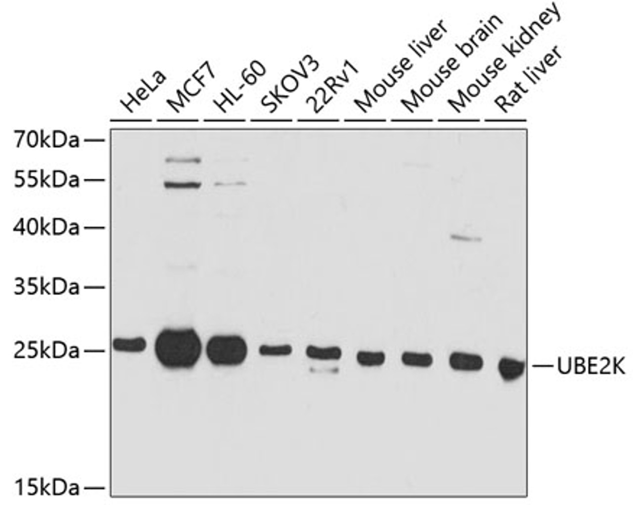 Western blot analysis of extracts of various cell lines, using UBE2K antibody (13-236) at 1:1000 dilution.<br/>Secondary antibody: HRP Goat Anti-Rabbit IgG (H+L) at 1:10000 dilution.<br/>Lysates/proteins: 25ug per lane.<br/>Blocking buffer: 3% nonfat dry milk in TBST.<br/>Detection: ECL Enhanced Kit.<br/>Exposure time: 30s.
