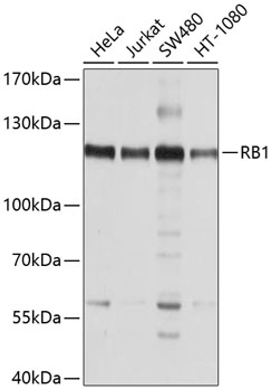 Western blot analysis of extracts of various cell lines, using RB1 antibody (13-425) at 1:1000 dilution.<br/>Secondary antibody: HRP Goat Anti-Rabbit IgG (H+L) at 1:10000 dilution.<br/>Lysates/proteins: 25ug per lane.<br/>Blocking buffer: 3% nonfat dry milk in TBST.<br/>Detection: ECL Basic Kit.<br/>Exposure time: 10s.