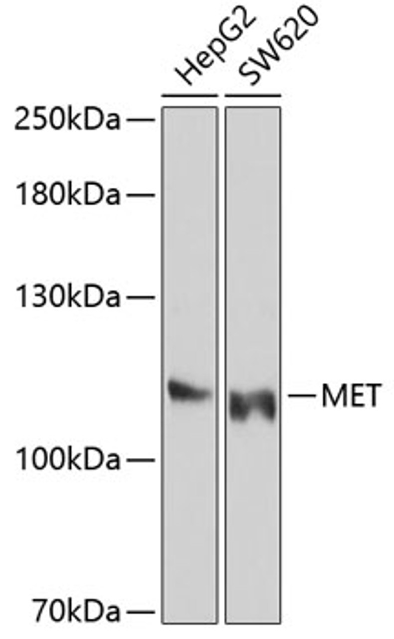 Western blot analysis of extracts of various cell lines, using MET Antibody (13-495) at 1:1000 dilution.<br/>Secondary antibody: HRP Goat Anti-Mouse IgG (H+L) (AS003) at 1:10000 dilution.<br/>Lysates/proteins: 25ug per lane.<br/>Blocking buffer: 3% nonfat dry milk in TBST.<br/>Detection: ECL Enhanced Kit.<br/>Exposure time: 30s.